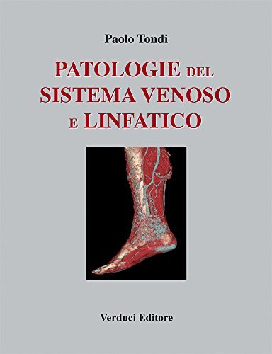 https://m.media-amazon.com/images/I/41qnqej04jL.jpg